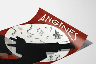 angines-2