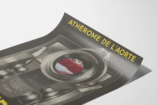 bi-citrol-marinier-atherome-de-laorte