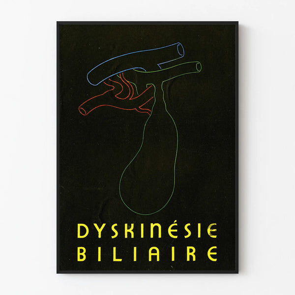 dyskinesie-biliaire