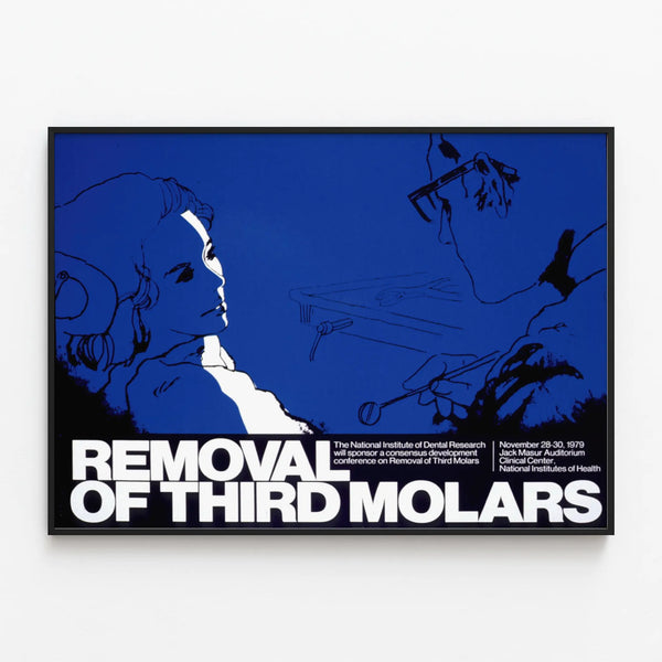 removal-of-third-molars
