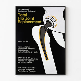 total-hip-joint-replacement